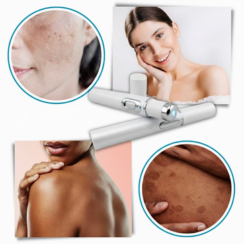 STYLO ANTI ACNÉ, BOUTON, ROUGEUR, TACHES NOIR, CICATRICES, DETOXIFICATION DE LA PEAU. POUR HOMME ET FEMME.
