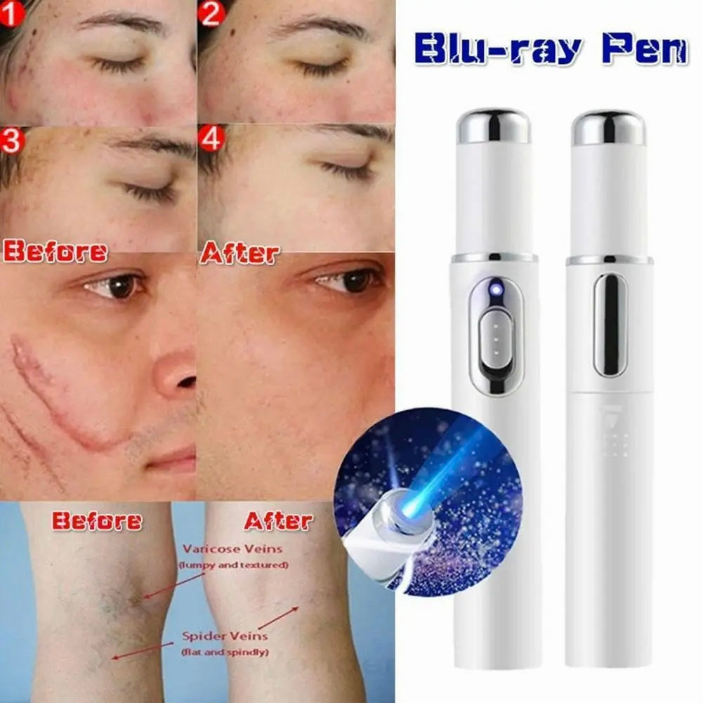 STYLO ANTI ACNÉ, BOUTON, ROUGEUR, TACHES NOIR, CICATRICES, DETOXIFICATION DE LA PEAU. POUR HOMME ET FEMME.