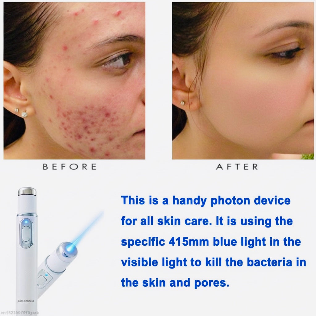 STYLO ANTI ACNÉ, BOUTON, ROUGEUR, TACHES NOIR, CICATRICES, DETOXIFICATION DE LA PEAU. POUR HOMME ET FEMME.